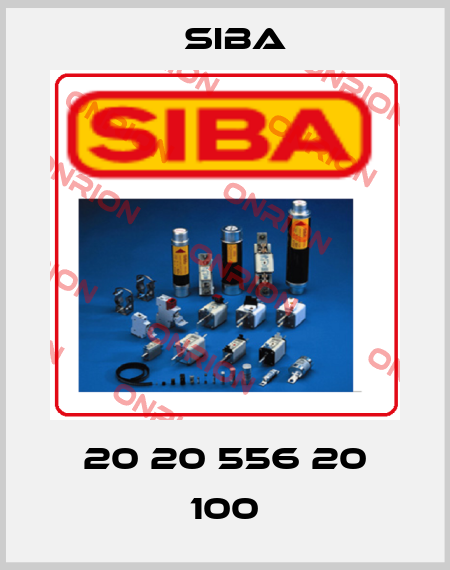 20 20 556 20 100 Siba